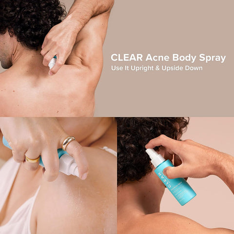 Paula’s Choice CLEAR Extra Strength Acne Kit + CLEAR Back & Body Spray, 4-Piece Kit to Treat & Prevent Severe Acne, Salicylic Acid (BHA) for Face & Body Acne and 5% Benzoyl Peroxide Treatment