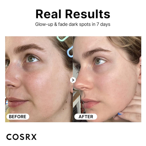 COSRX Pure Vitamin C Serum with Vitamin E & Hyaluronic Acid, Brightening & Hydrating Facial Serum for Fine Lines, Uneven Skin Tone & Dull Skin, 0.7oz/20g, Korean Skincare (Vitamin C 23% Serum)