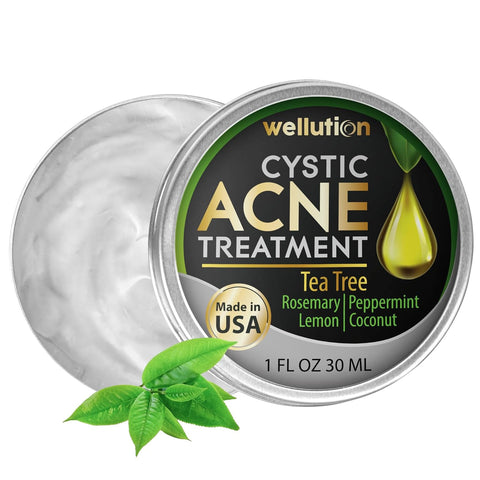 Wellution Cystic Acne Treatment Cream - Natural Pimple and Scar Remover with Tea Tree Oil - Effective Overnight Face Treatment for Acne Spots, Pimples and Scars - 1oz